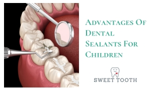 Advantages Of Dental Sealants For Children