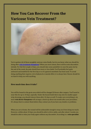 How You Can Recover From the Varicose Vein Treatment