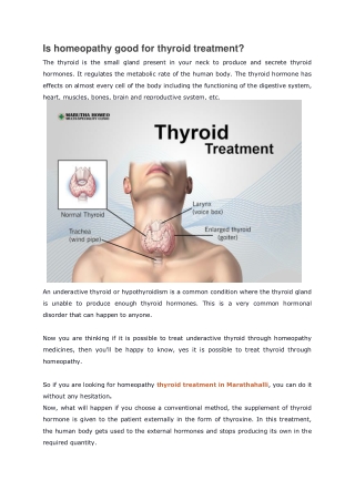 Is homeopathy good for thyroid treatment