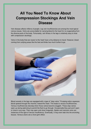 All You Need To Know About Compression Stockings And Vein Disease