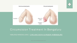 Best Circumcision Center in Bengaluru - Circumcision Hospital in Bengaluru