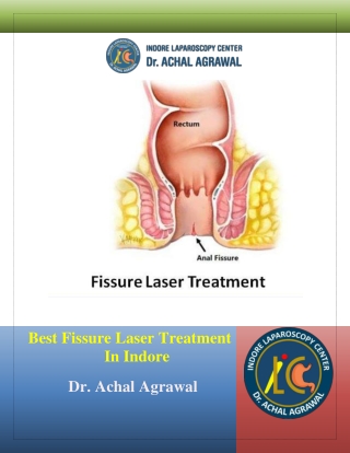 Best Fissure Laser Treatment in Indore – Dr. Achal Agrawal