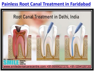 Visit For Painless Root Canal Treatment in Faridabad