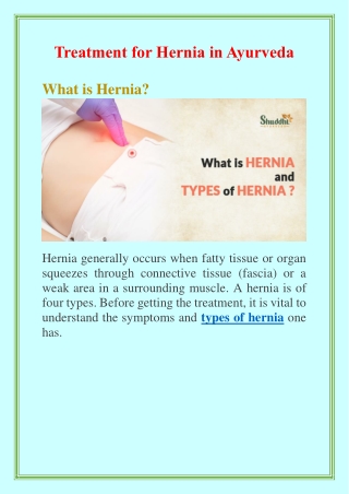 Hernia Without Operation