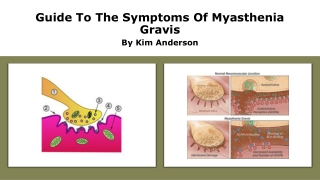 myasthenia gravis