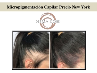 Micropigmentación Capilar Precio New York