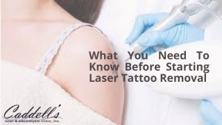 What You Need To Know Before Starting Laser Tattoo Removal