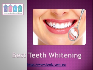 Best Teeth Whitening - (03-95788500) - BEDC