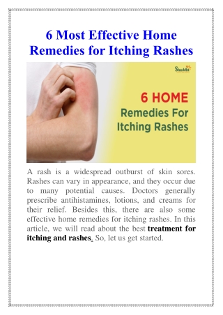 Home Remedies for Itching Rashes