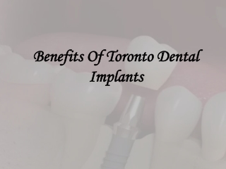 Benefits Of Toronto Dental Implants