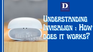 Understanding Invisalign: How does it works?