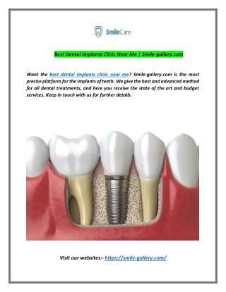 Best Dental Implants clinic near me