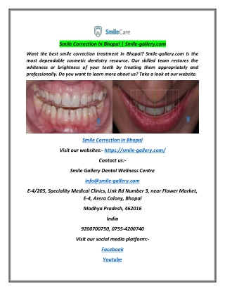 Smile Correction in Bhopal