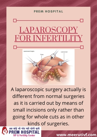 Laparoscopic Surgery for Infertility