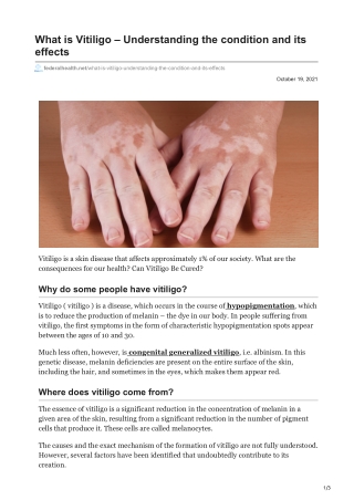 What is Vitiligo  Understanding the condition and its effects