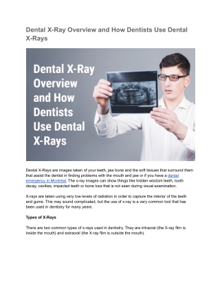 Dental X-Ray Overview and How Dentists Use Dental X-Rays