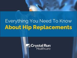 Everything You Need To Know About Hip Replacements