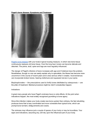 Paget’s bone disease- Symptoms and Treatment