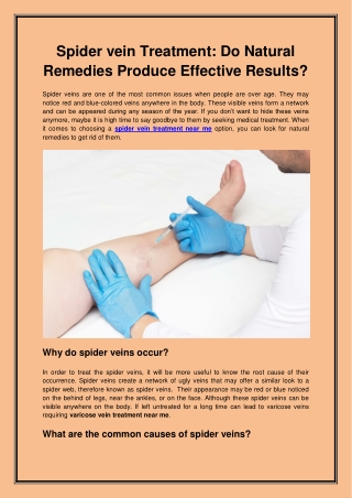 Spider vein Treatment Do Natural Remedies Produce Effective Results