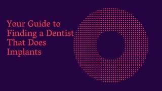 Your Guide to Finding a Dentist That Does Implants