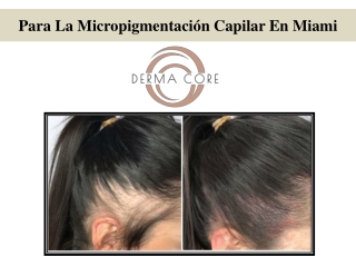 Para La Micropigmentación Capilar En Miami