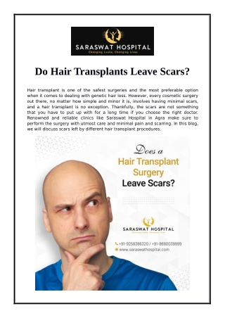 Do Hair Transplants Leave Scars?