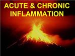 Inflammation 5 OBJECTIVES 1 Concept Understand the chain, progression, or sequence of vascular and cellular events in th