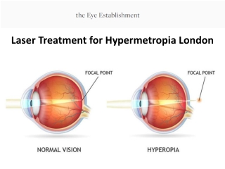 Laser Treatment for Hypermetropia London