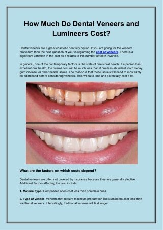 How Much Do Dental Veneers and Lumineers Cost