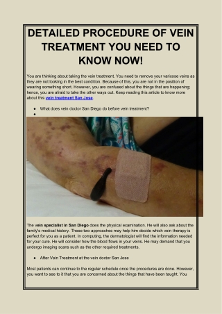 DETAILED PROCEDURE OF VEIN TREATMENT YOU NEED TO KNOW NOW