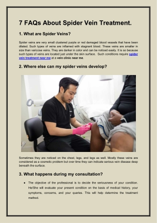 7 FAQs About Spider Vein Treatment