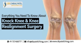 Everything You Need To Know About Knock Knee & Knee Realignment Surgery