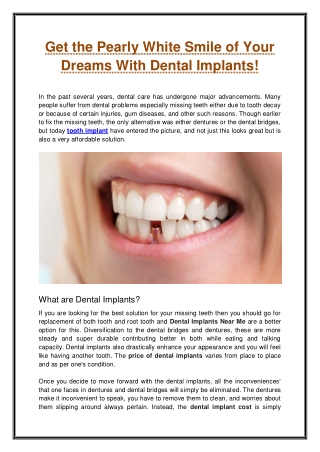 Get the Pearly White Smile of Your Dreams With Dental Implants