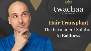 Is Hair Transplant Permanent?