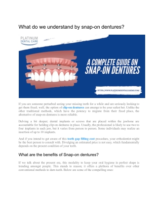 A complete guide on Snap-on Dentures