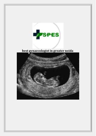 best gynaecologist in greater noida