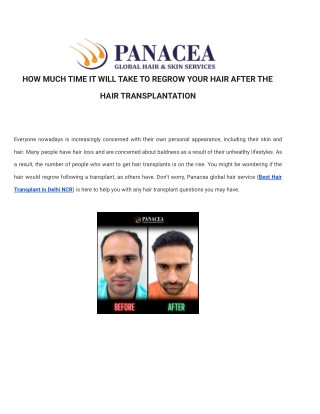 HOW MUCH TIME IT WILL TAKE TO REGROW YOUR HAIR AFTER THE HAIR TRANSPLANTATION