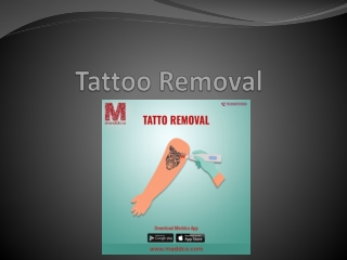 tatoo removal ppt