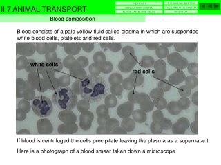 Blood consists of a pale yellow fluid called plasma in which are suspended white blood cells, platelets and red cells.