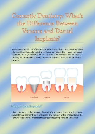 Cosmetic Dentistry: What's the Difference Between Veneers and Dental Implants?