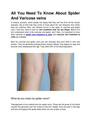 All You Need To Know About Spider And Varicose veins