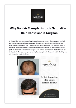 Why Do Hair Transplants Look Natural – Hair Transplant in Gurgaon