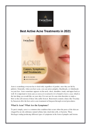 Best Active Acne Treatments in 2021