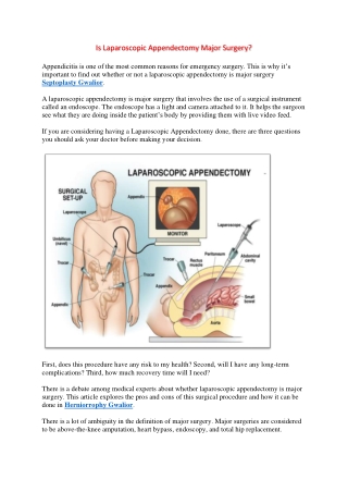 Is Laparoscopic Appendectomy Major Surgery?