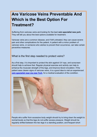 Are Varicose Veins Preventable And Which is the Best Option For Treatment