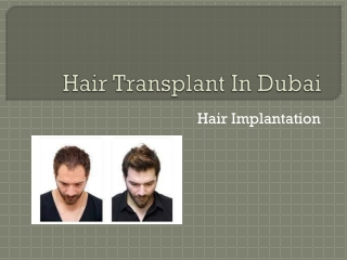 Hair Transplant In Dubai