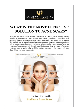 What Is the Most Effective Solution to Acne Scars?