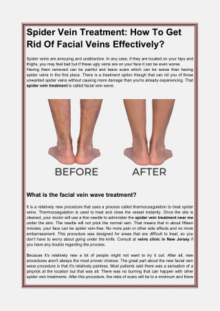 Spider Vein Treatment How To Get Rid Of Facial Veins Effectively