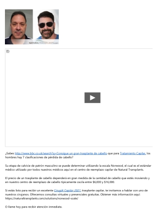 Obtener información gratuita Trasplante de Cabello Post 2021