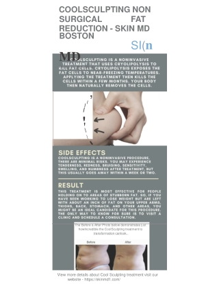 CoolSculpting: Non Surgical Fat Reduction | Skin MD Boston